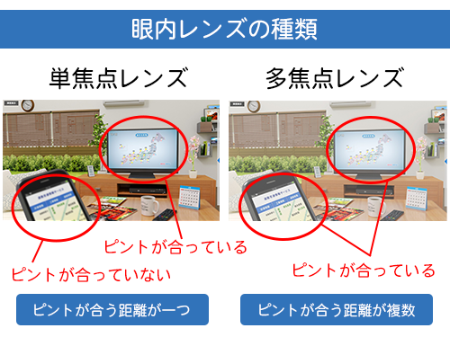 単焦点眼内レンズと多焦点眼内レンズ